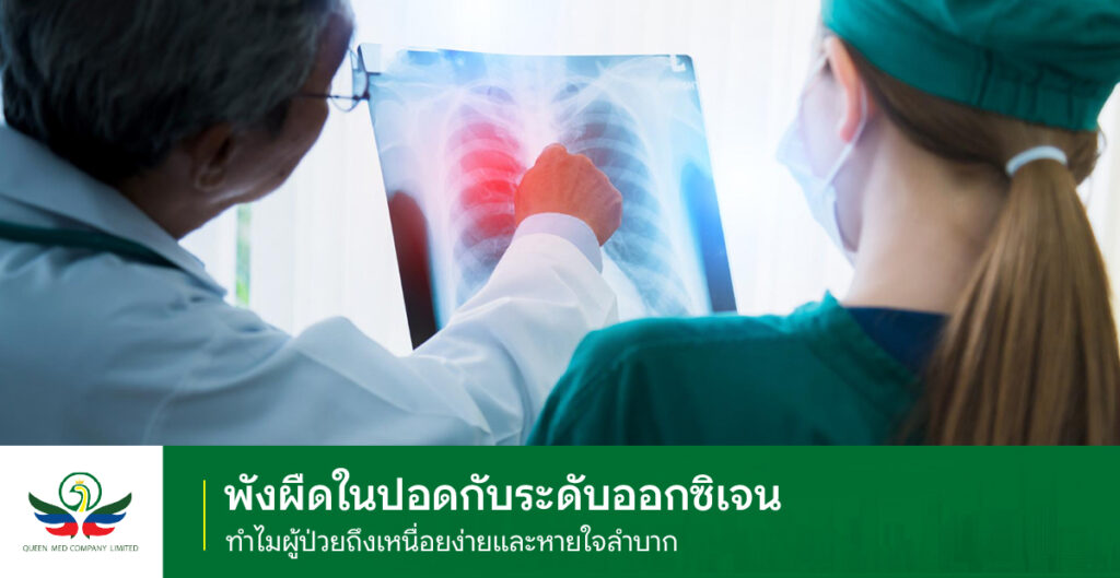 พังผืดในปอด